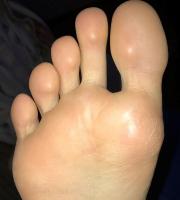 boy feet big toes